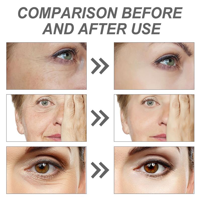Retinol Rimpelverwijderend Gez - The Ordinary Serum Hyaluronic Acid recensie en prijs